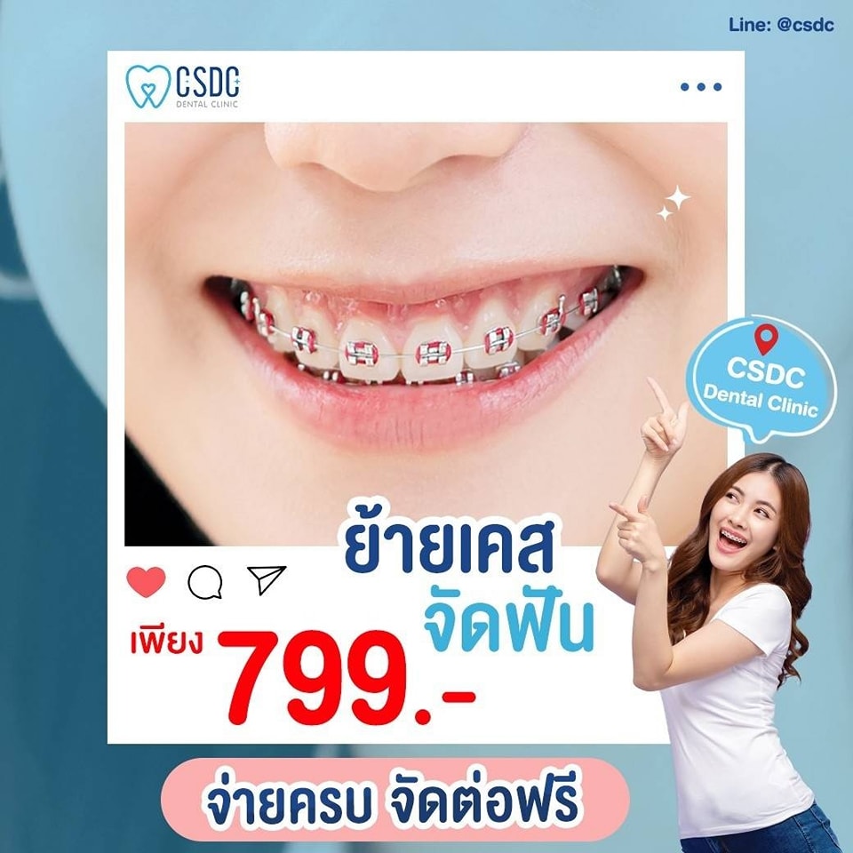 CSDC Dental Clinic จัดฟัน ทำฟัน 10 สาขา เชียงใหม่ Facebook ad