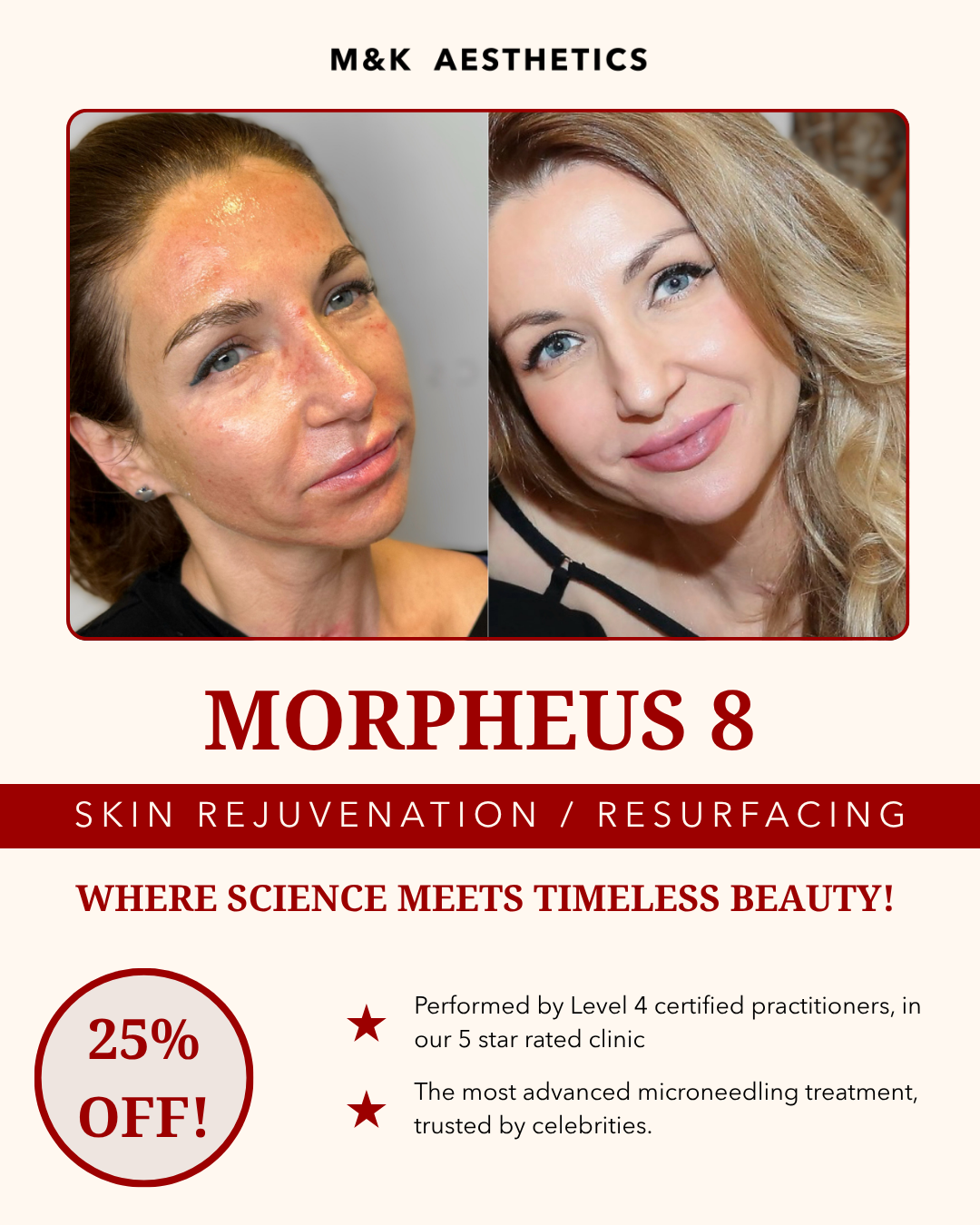 M&K Aesthetics Facebook ad: London! Ready for Tighter, Smoother, Younger-Looking Skin?