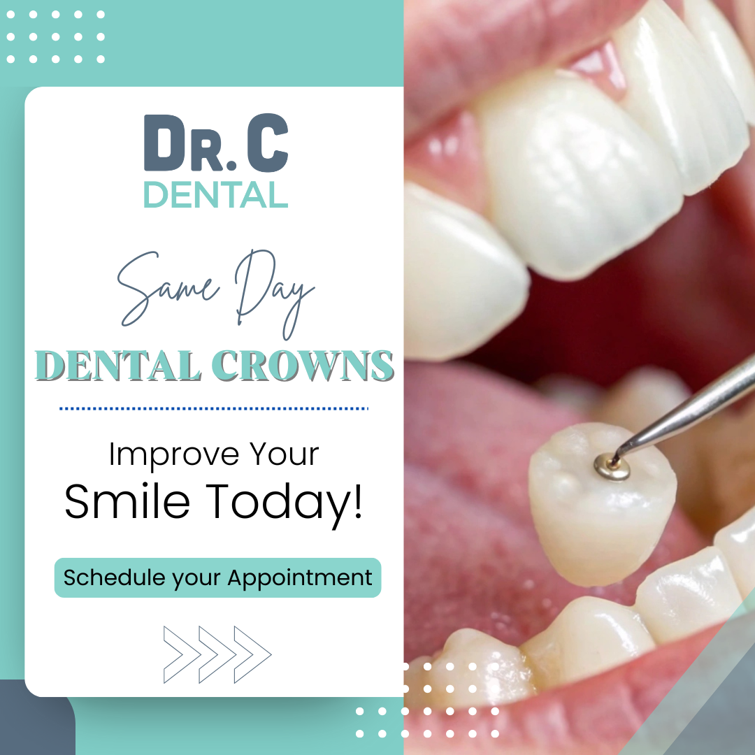 Dr. C Dental South Hill Facebook ad: Get a Permanent Crown in Just One Visit