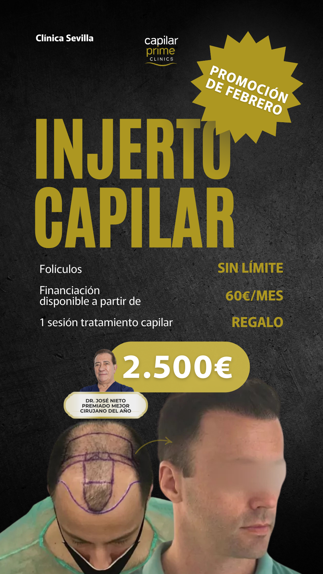 Capilar Prime Clinics Facebook ad from Mar 4, 2026