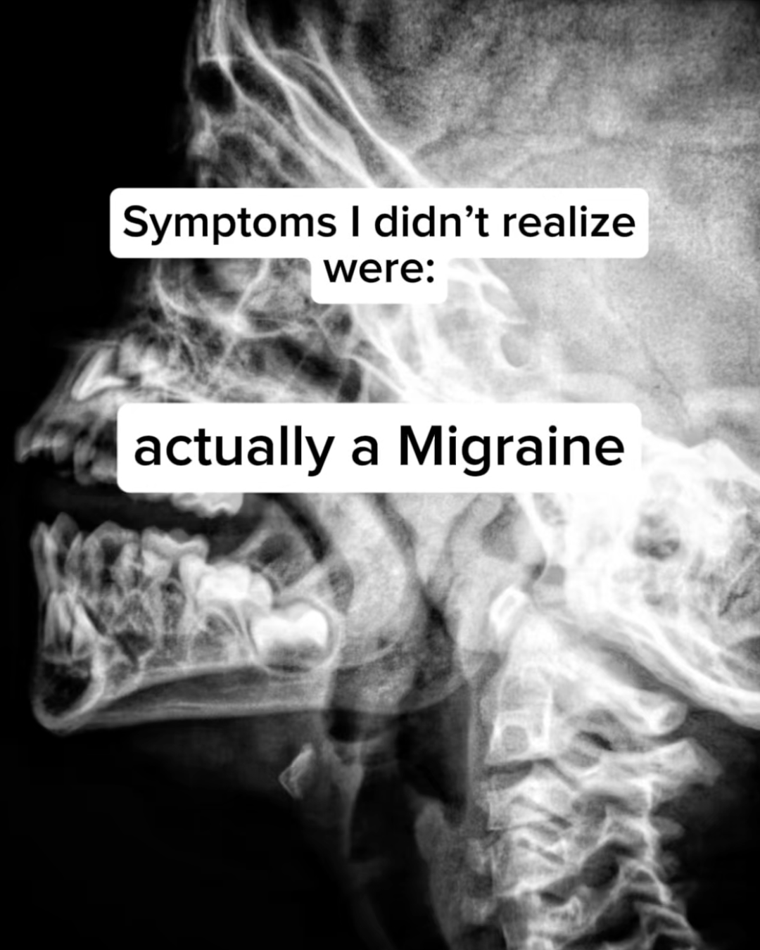 Allison Arnold - Migraine Coach Facebook ad