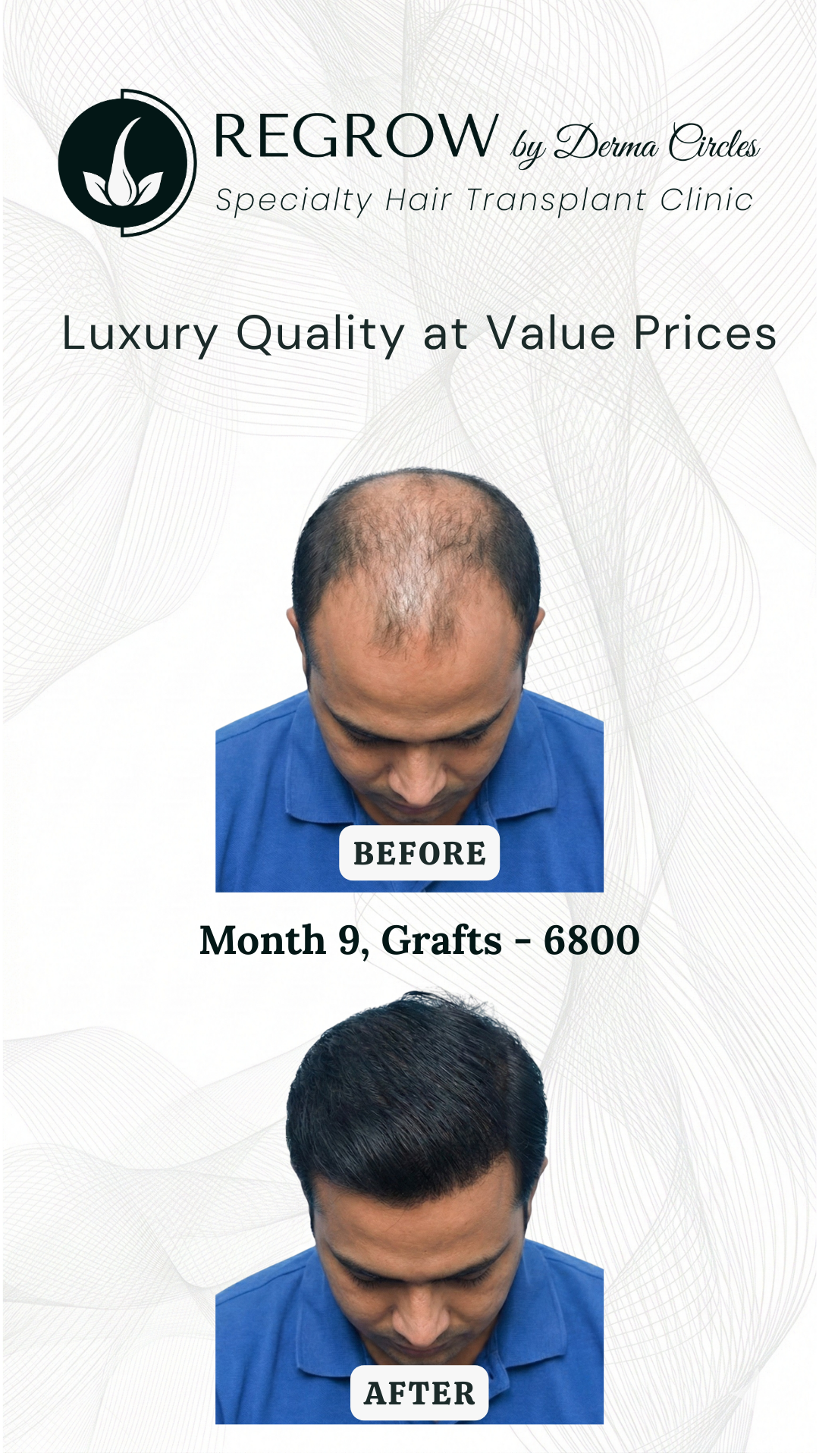 Regrow By Derma Circles Facebook ad from Apr 13, 2026