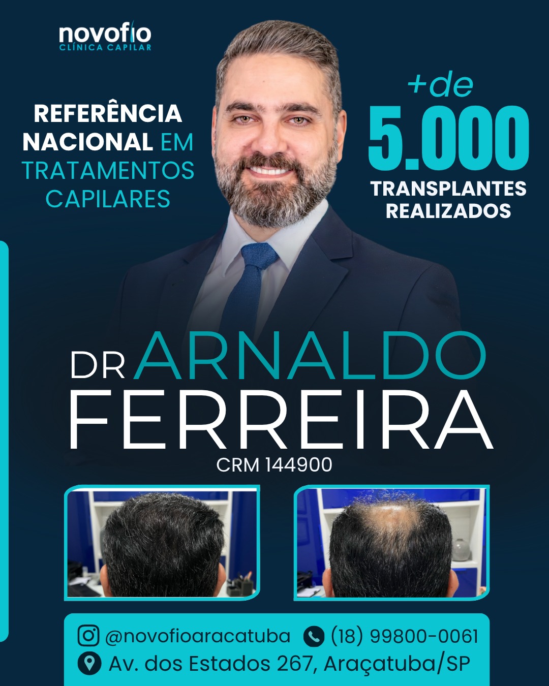 Novofio Araçatuba Clínica Capilar Facebook ad