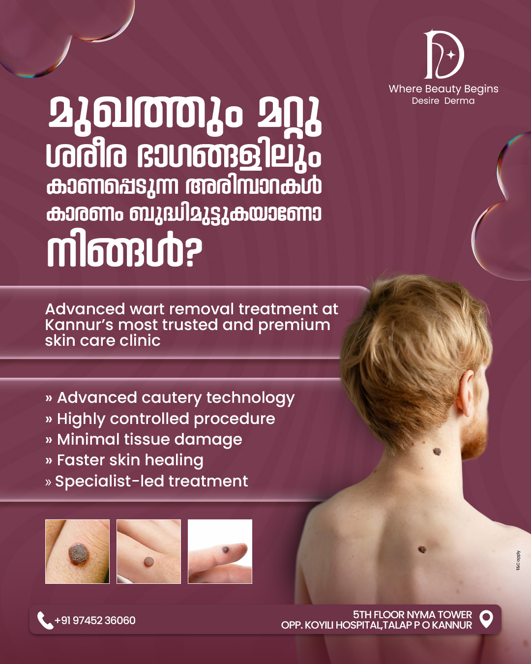 Desire Derma Skin Clinics Facebook ad