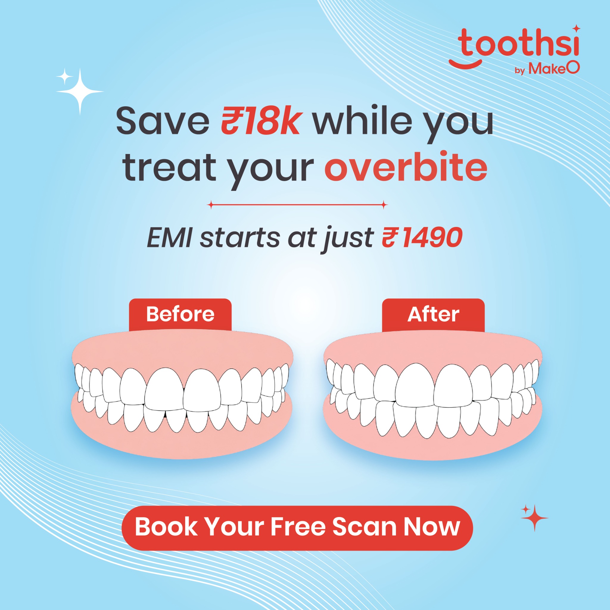 toothsi by makeO Facebook ad: You wouldn’t want to miss out on this!