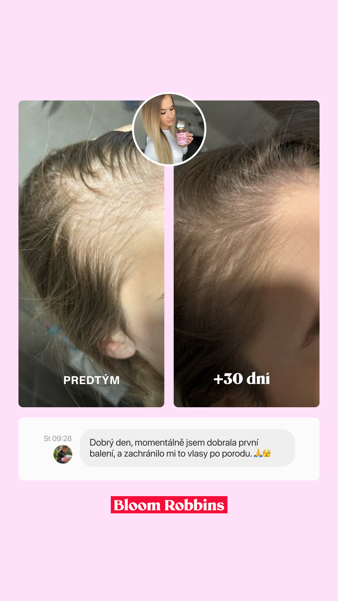 Bloom Robbins SK/CZ Facebook ad