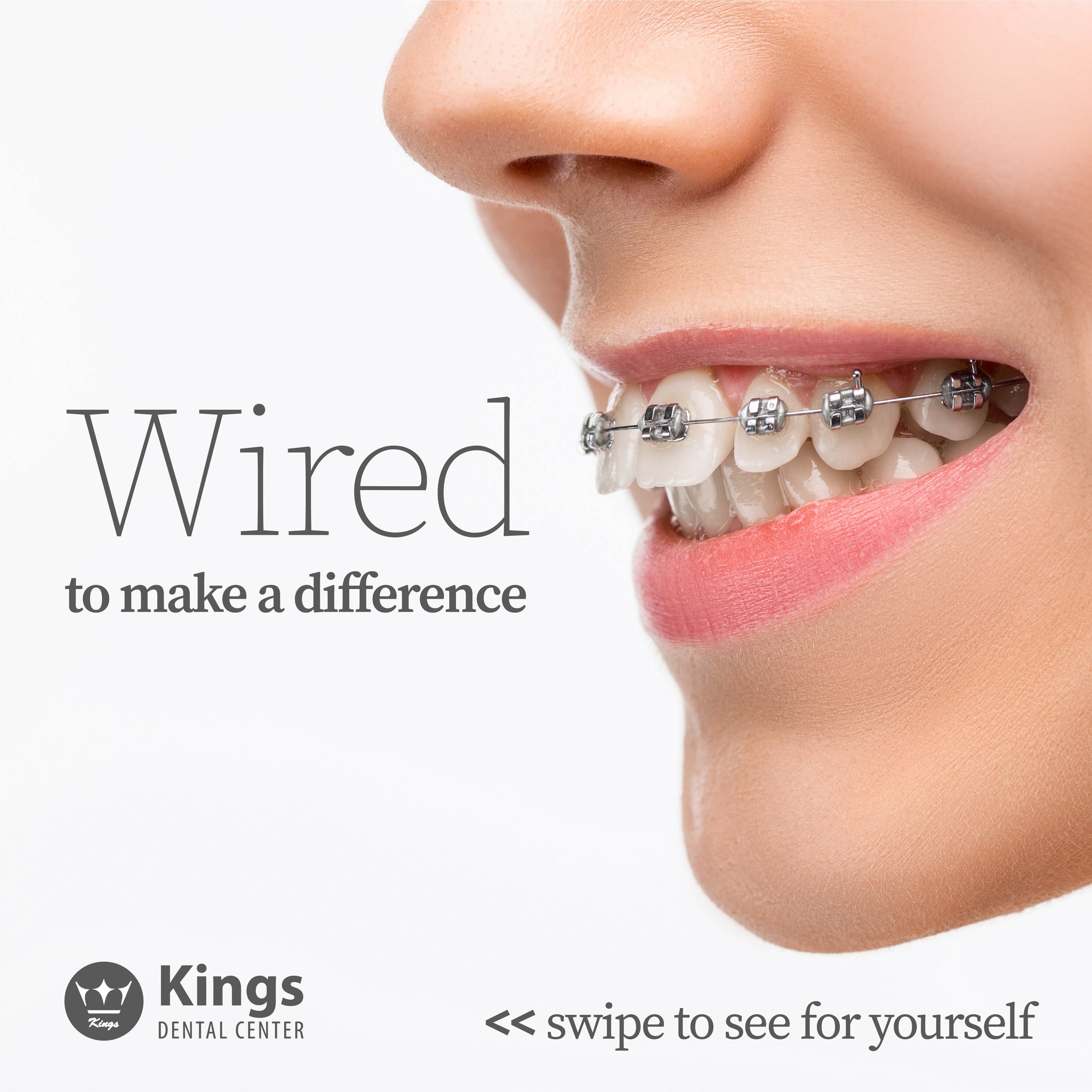 Kings Dental Center Al Khor Facebook ad: Chat on Messenger