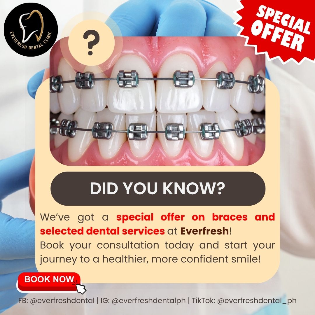 Everfresh Dental Clinic - Alabang Facebook ad: SPECIAL OFFER!