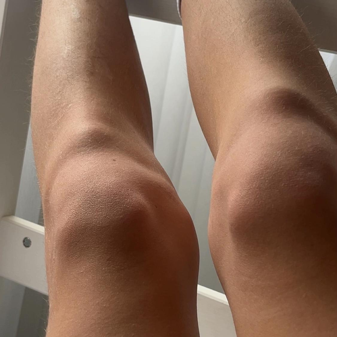 Monica Carver Facebook ad: If your child has knee pain, read this