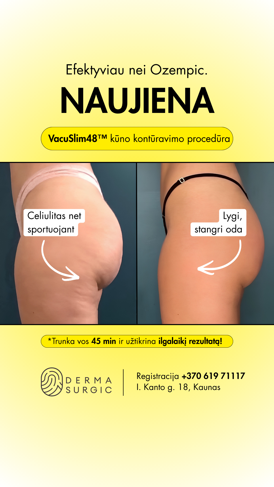 DermaSurgic estetinės medicinos ir chirurgijos centras Facebook ad