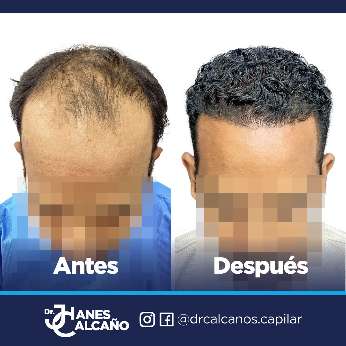 Dr. Jhanes Calcaño Facebook ad