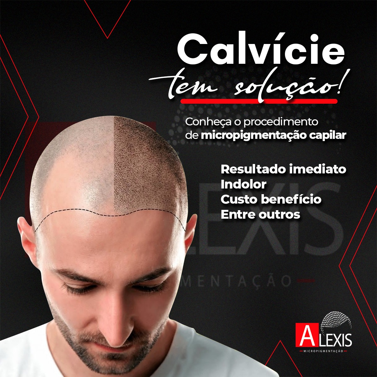 Alexis Micropigmentação Capilar Facebook ad: Que tal você com um visual novo e…