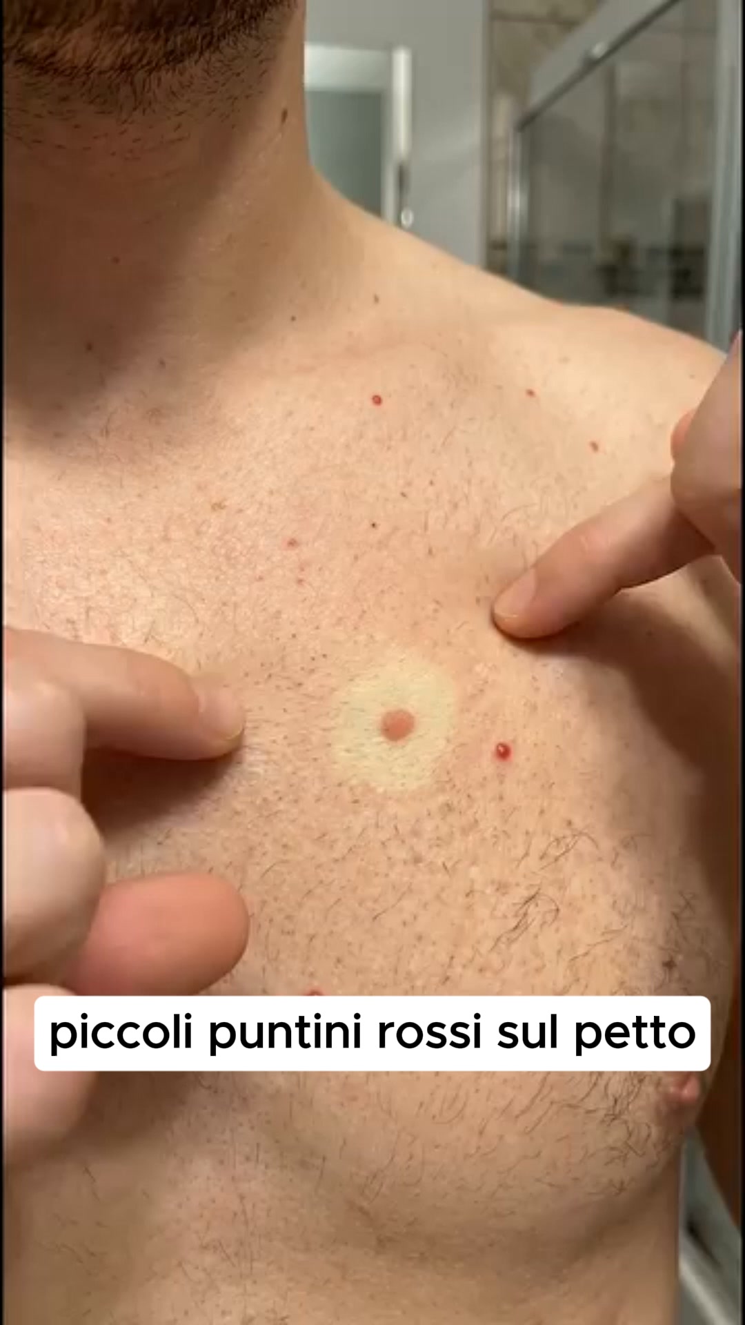 Dott. Alessandro Rinaldi - Endocrinologo Facebook ad: Ho fatto TUTTO per perdere peso. Tutto tranne questo.