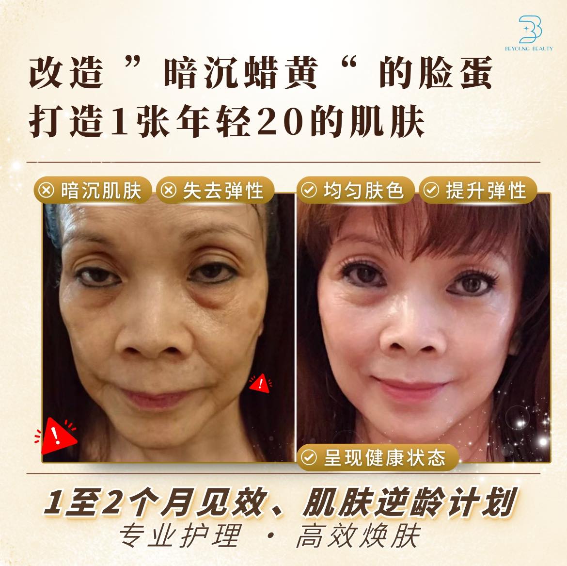 天麗生技医学美容保养品-马来西亚Mandi老师 Facebook ad: 焕肤升级 · 年轻20岁的秘密