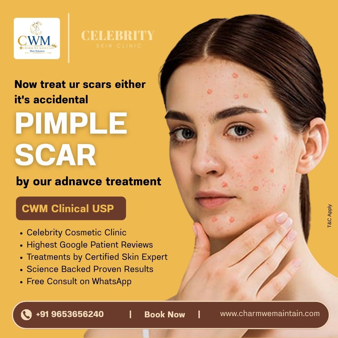 Charm We Maintain Facebook ad: Advanced Pimple Scar Treatment in Andheri is designed to…