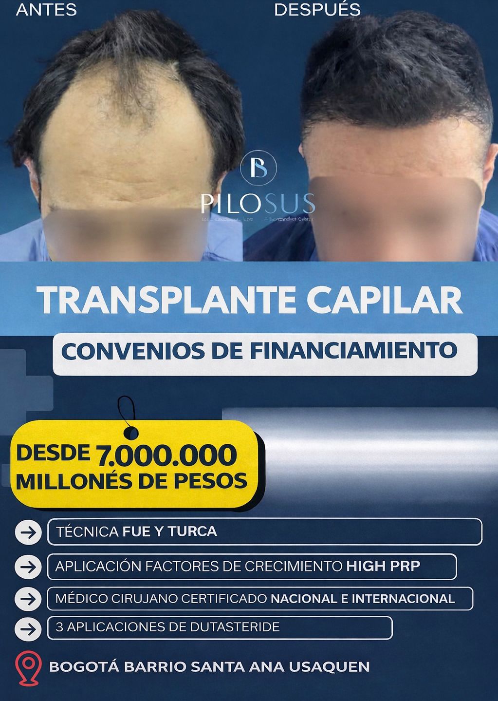 Pilosus Trasplante Capilar Facebook ad: ¡Valoración sin COSTO!