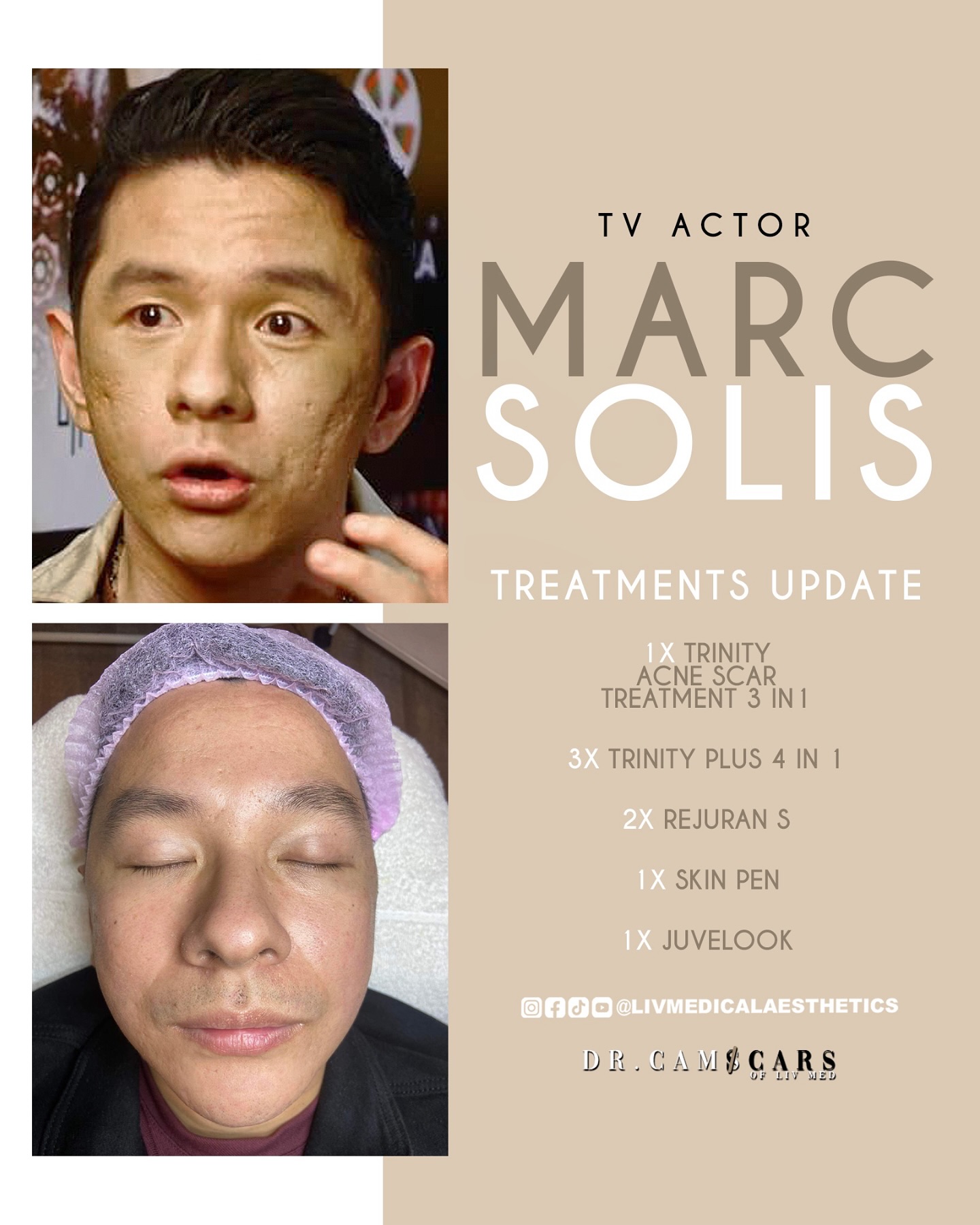 Liv Medical Aesthetics and Wellness Center Facebook ad