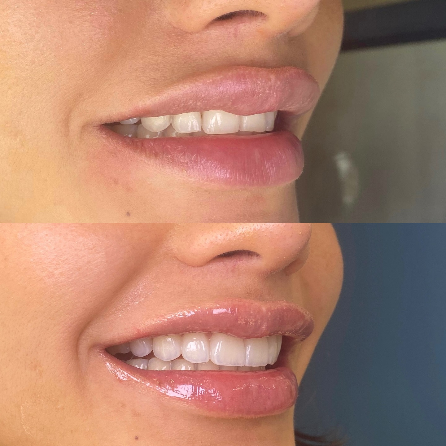Dr. Smile Colombia Facebook ad