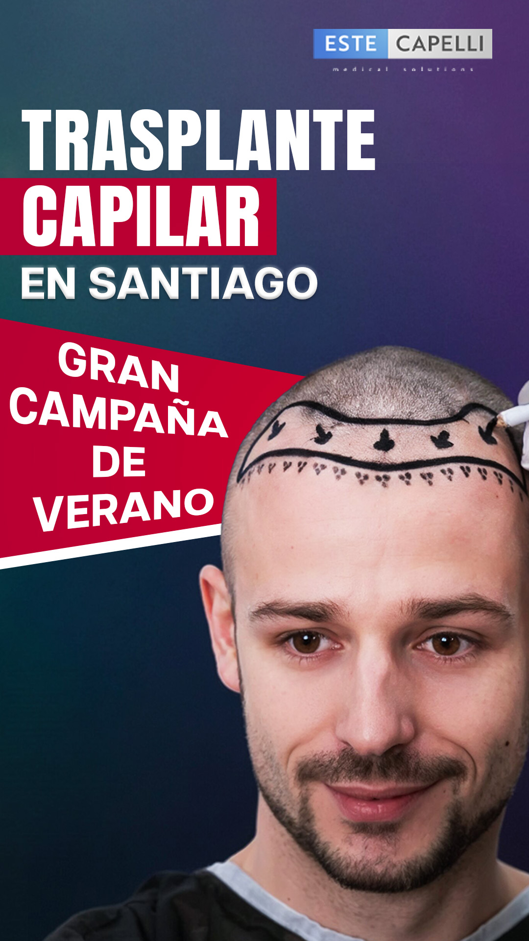 Estecapelli España Facebook ad