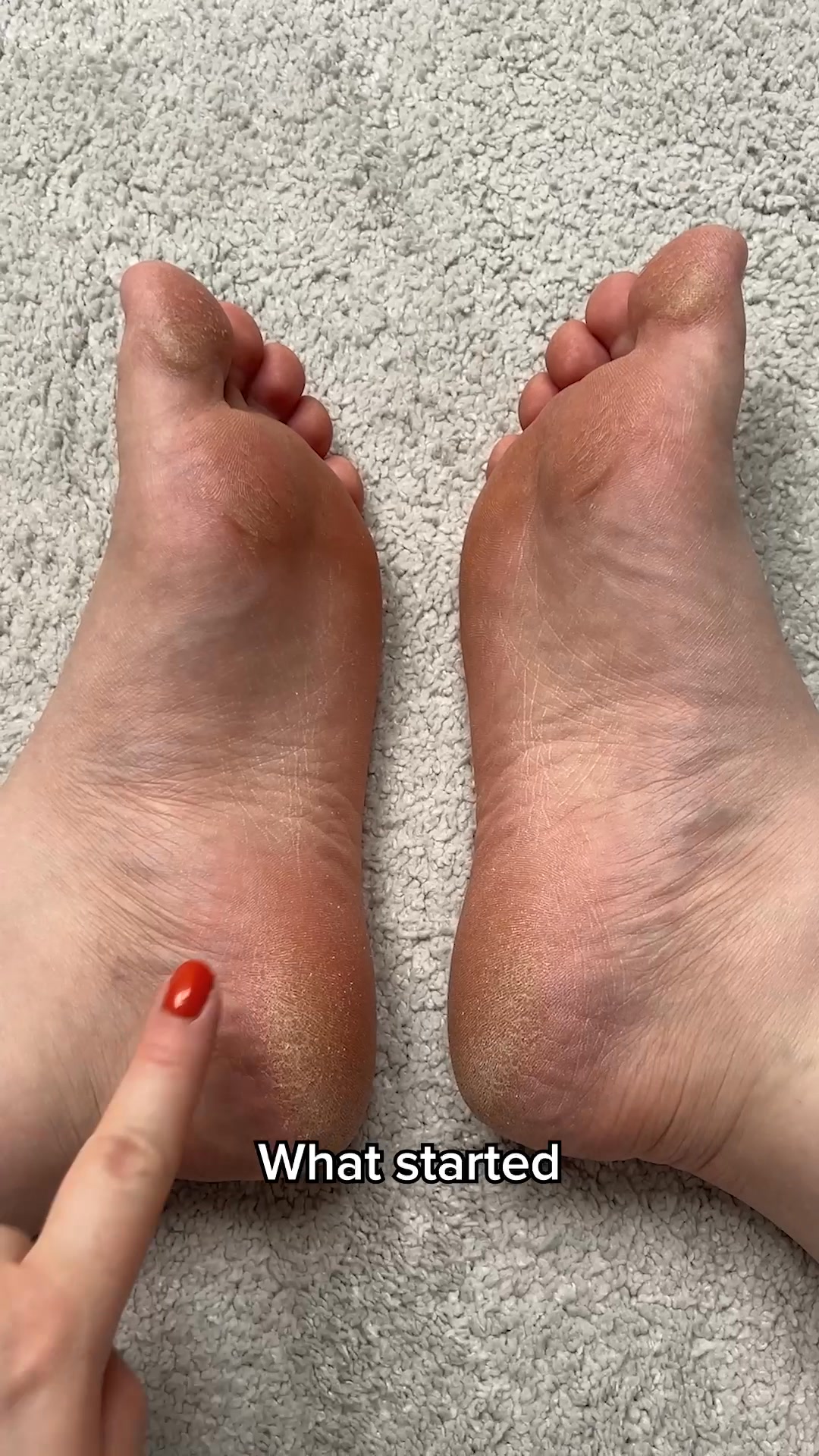 Nuvé Facebook ad: Smooth feet. In minutes. Guaranteed.