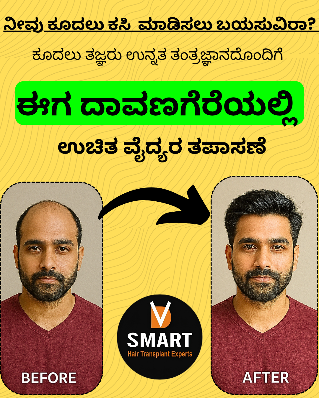 V-Smart Hair Transplant & Skin Solutions Facebook ad