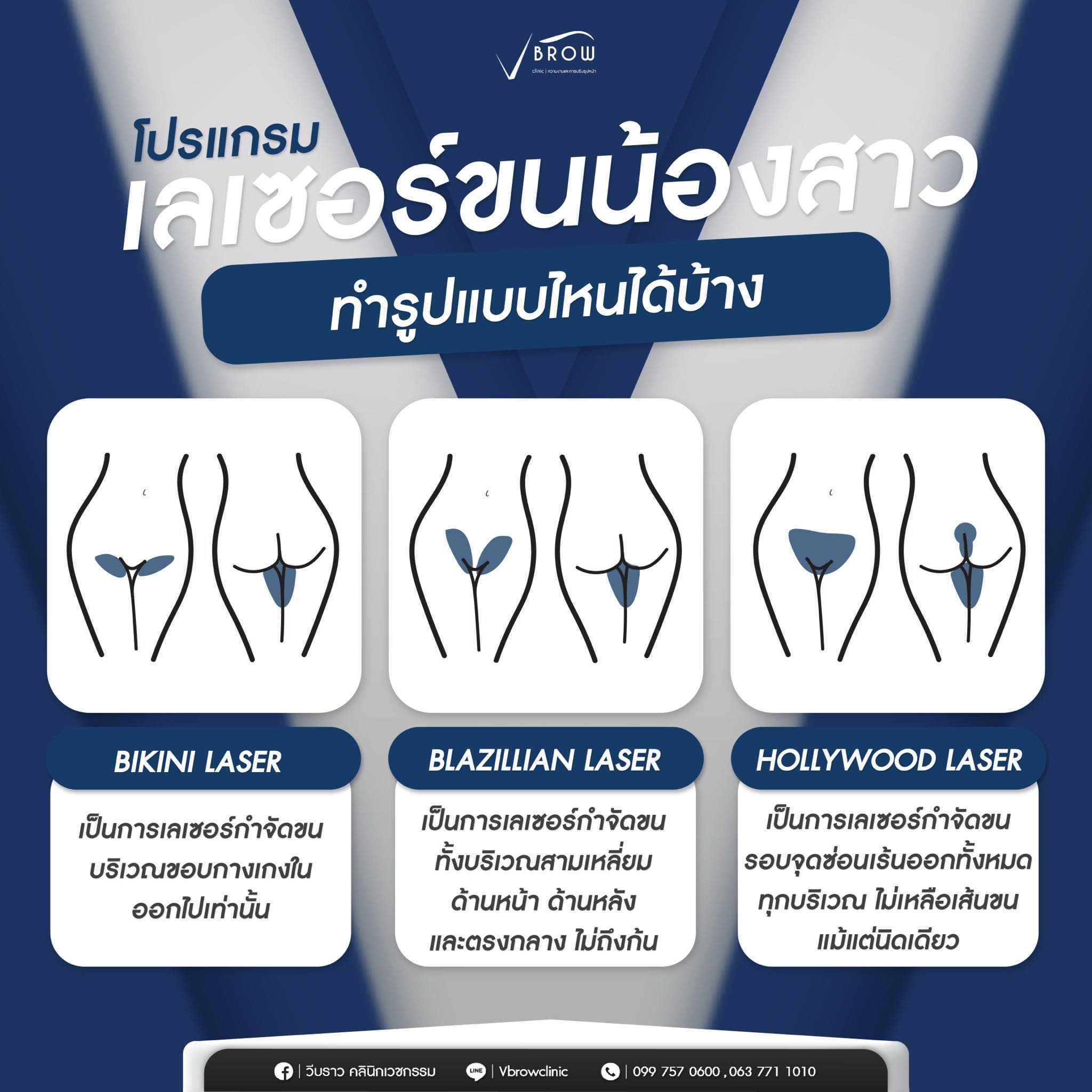 Vbrow clinic - วีบราวคลินิก Facebook ad