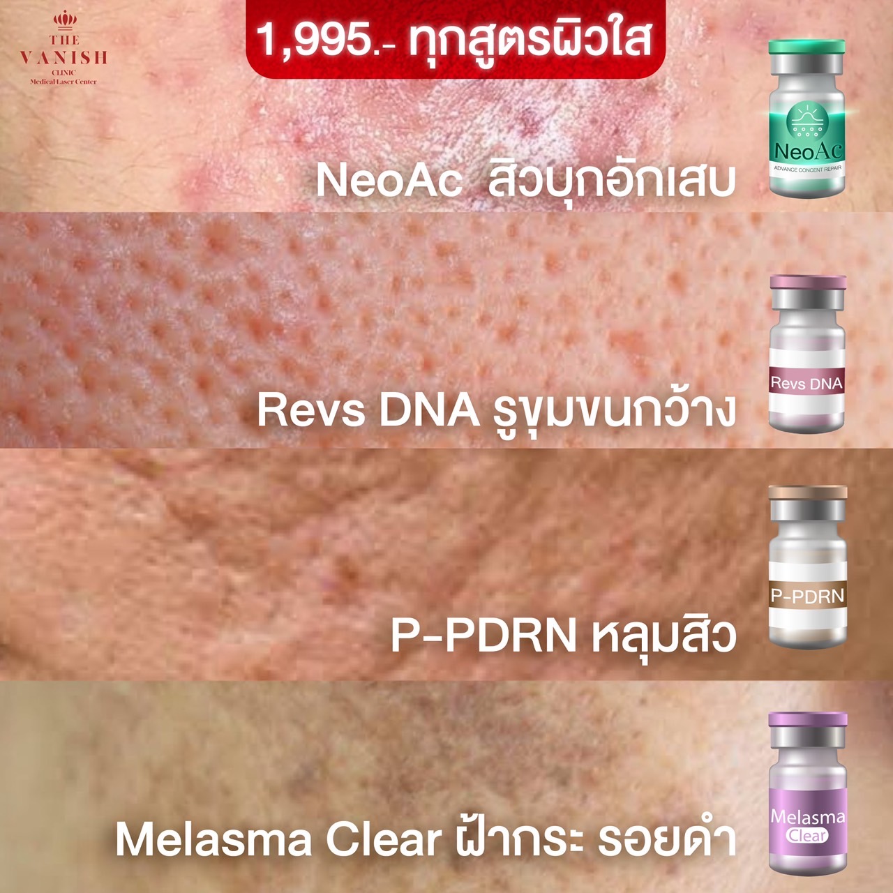 The Vanish Laser Center Facebook ad