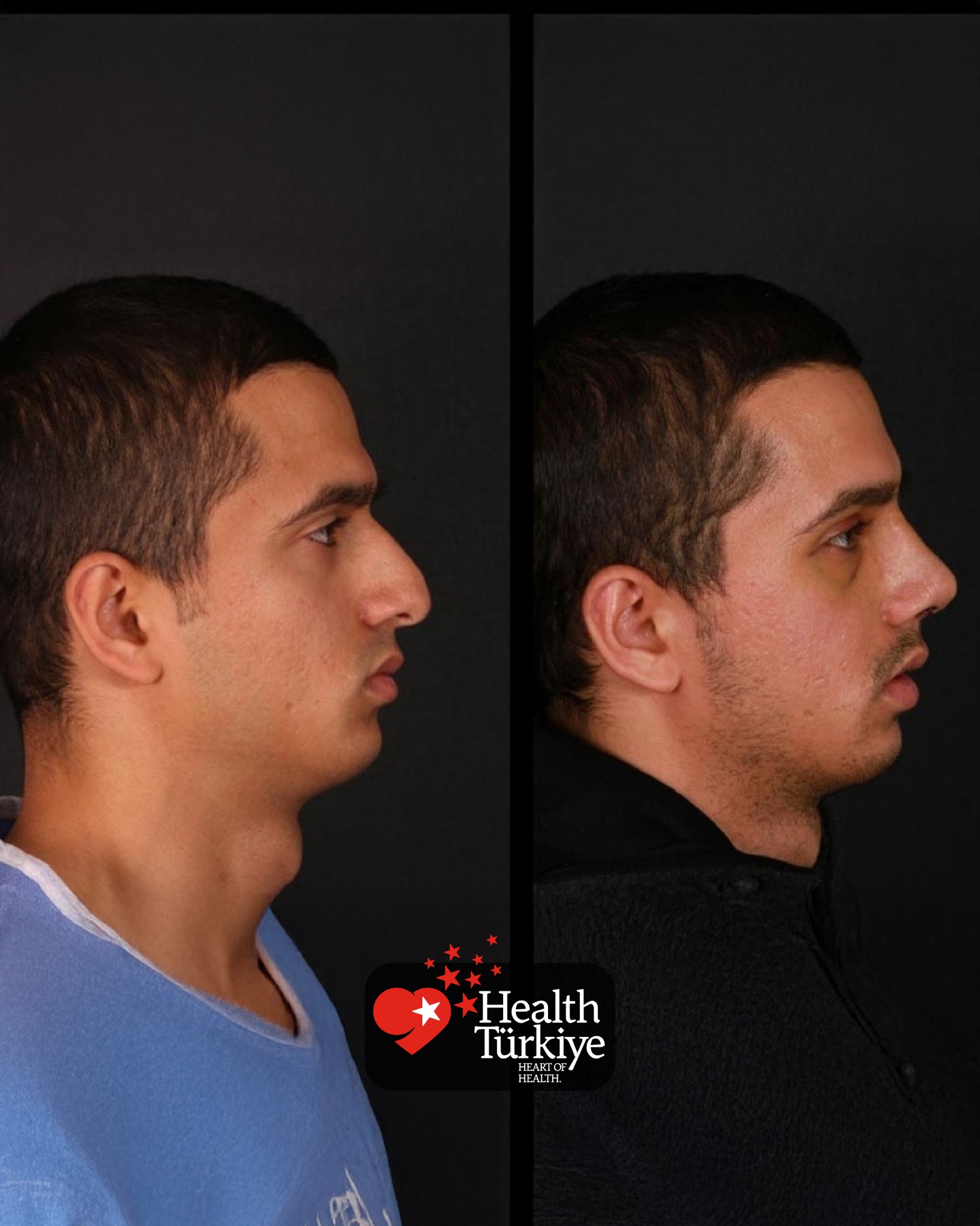 Avolin Health Turkey Facebook ad from May 31, 2026