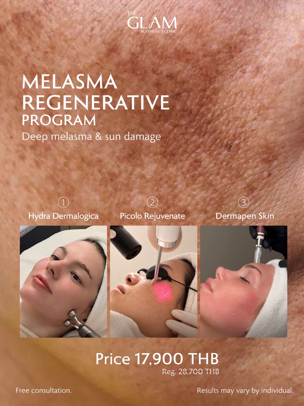 The GLAM Clinic Facebook ad: Booking Now