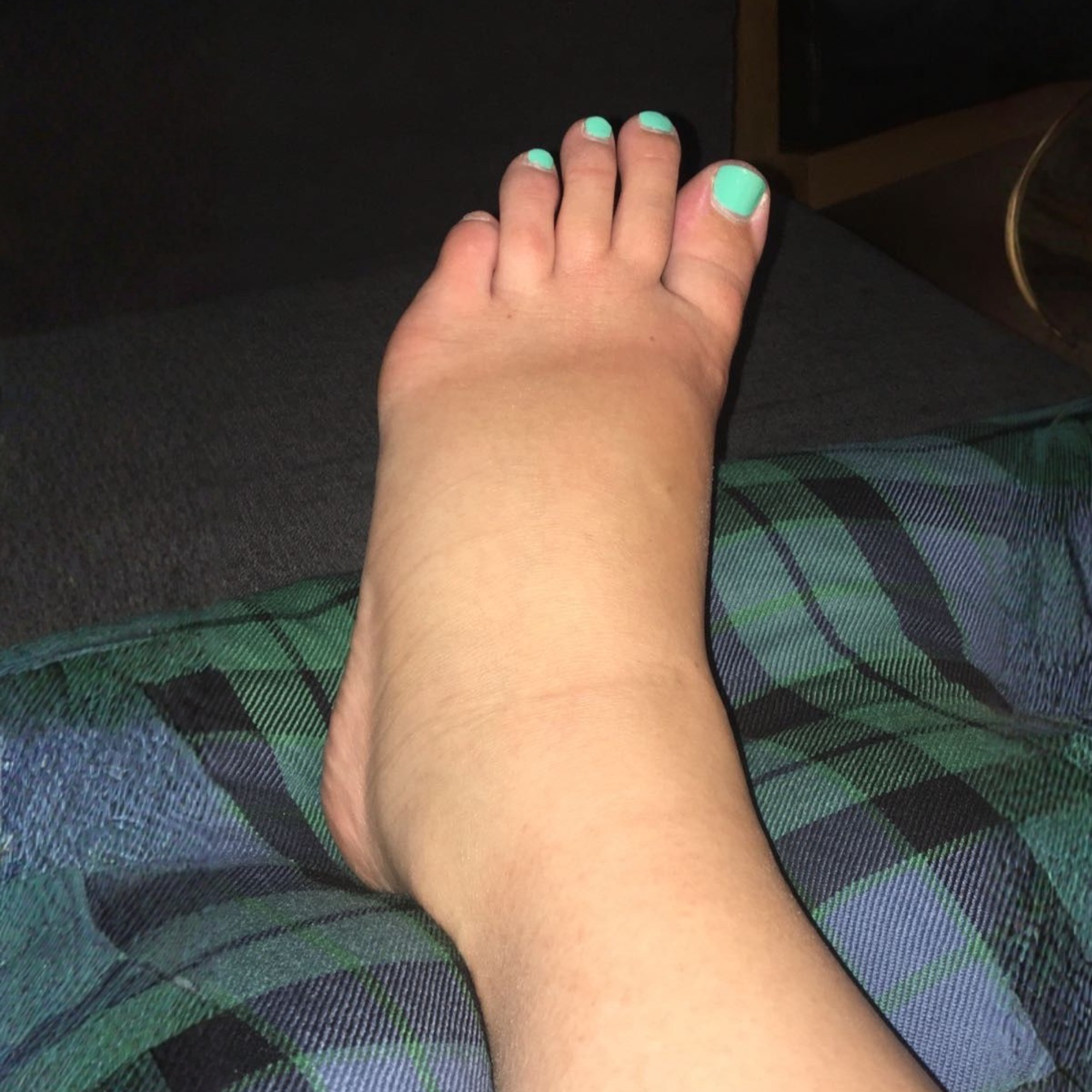 Tina Cooper Facebook ad: I thought swollen ankles were just part of my job. turns…