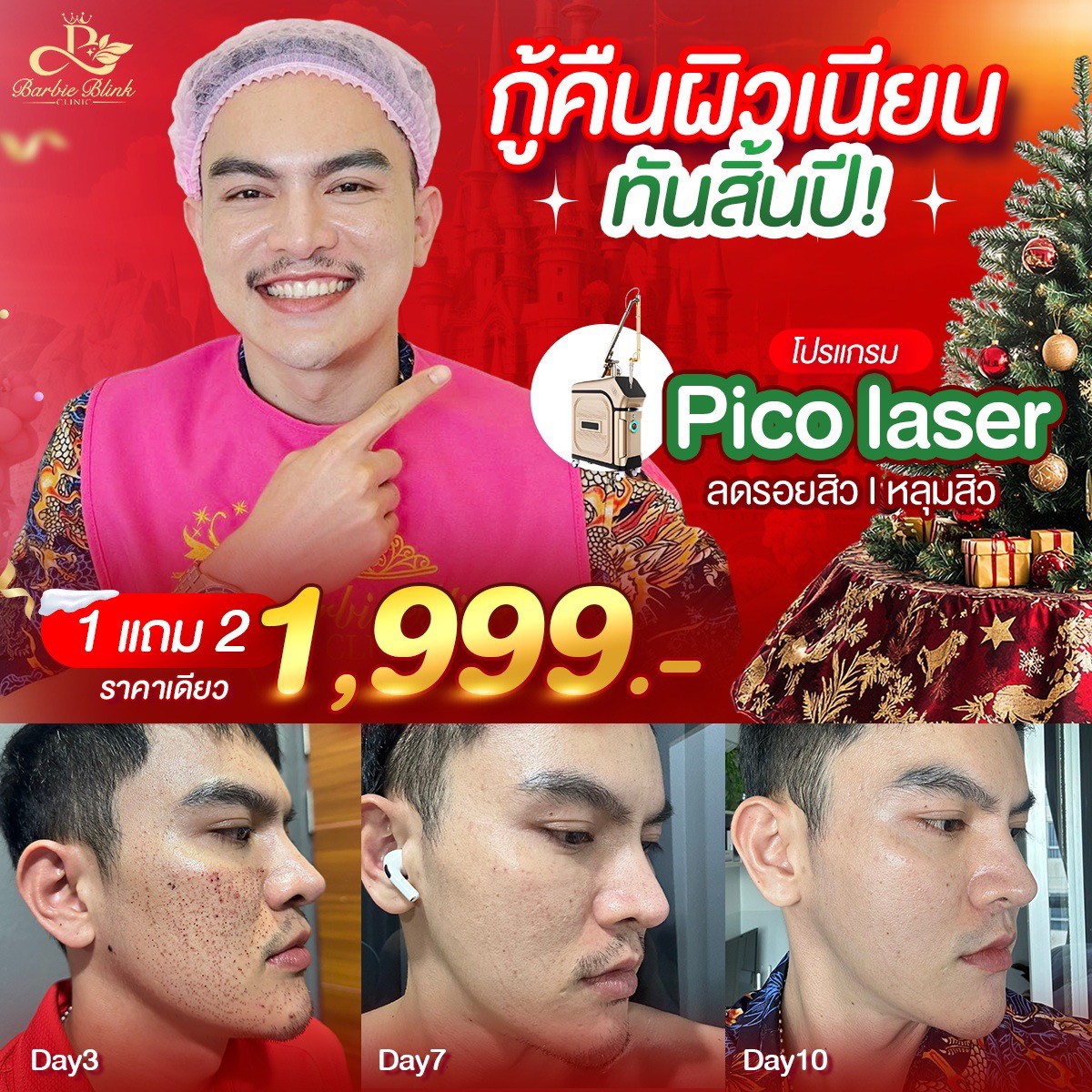 Barbie blink clinic สาขา นครศรีธรรมราช Facebook ad: บอกลาหน้าสิว สยบหลุมสิว ด้วยโปรแกรม Pico