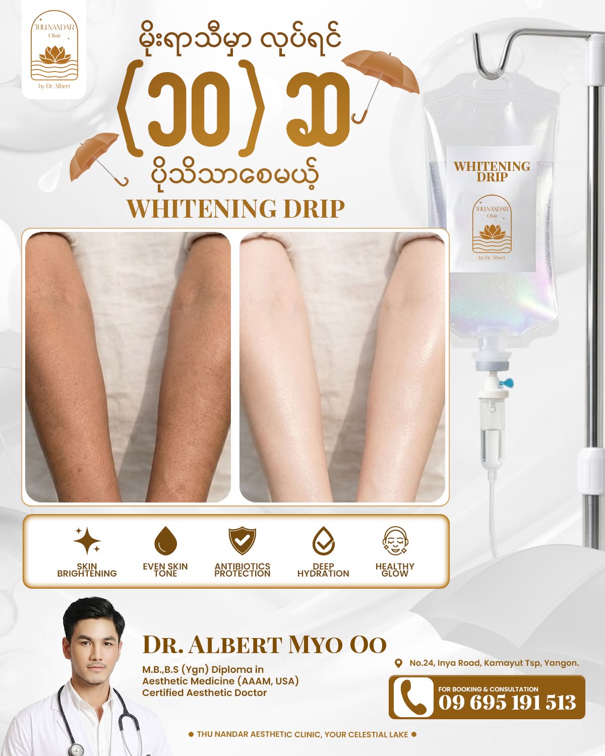 Thu Nandar Aesthetic Clinic Facebook ad: မိုးရာသီမှာ လုပ်ရင် (၁၀) ဆ ပိုသိသာစေမယ့် Whitening Drip