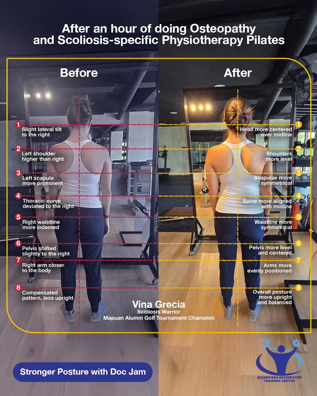 Dr. Jam Alcantara, Osteopath, Naprapath Facebook ad: Realignment in motion-after one session, posture looks more…