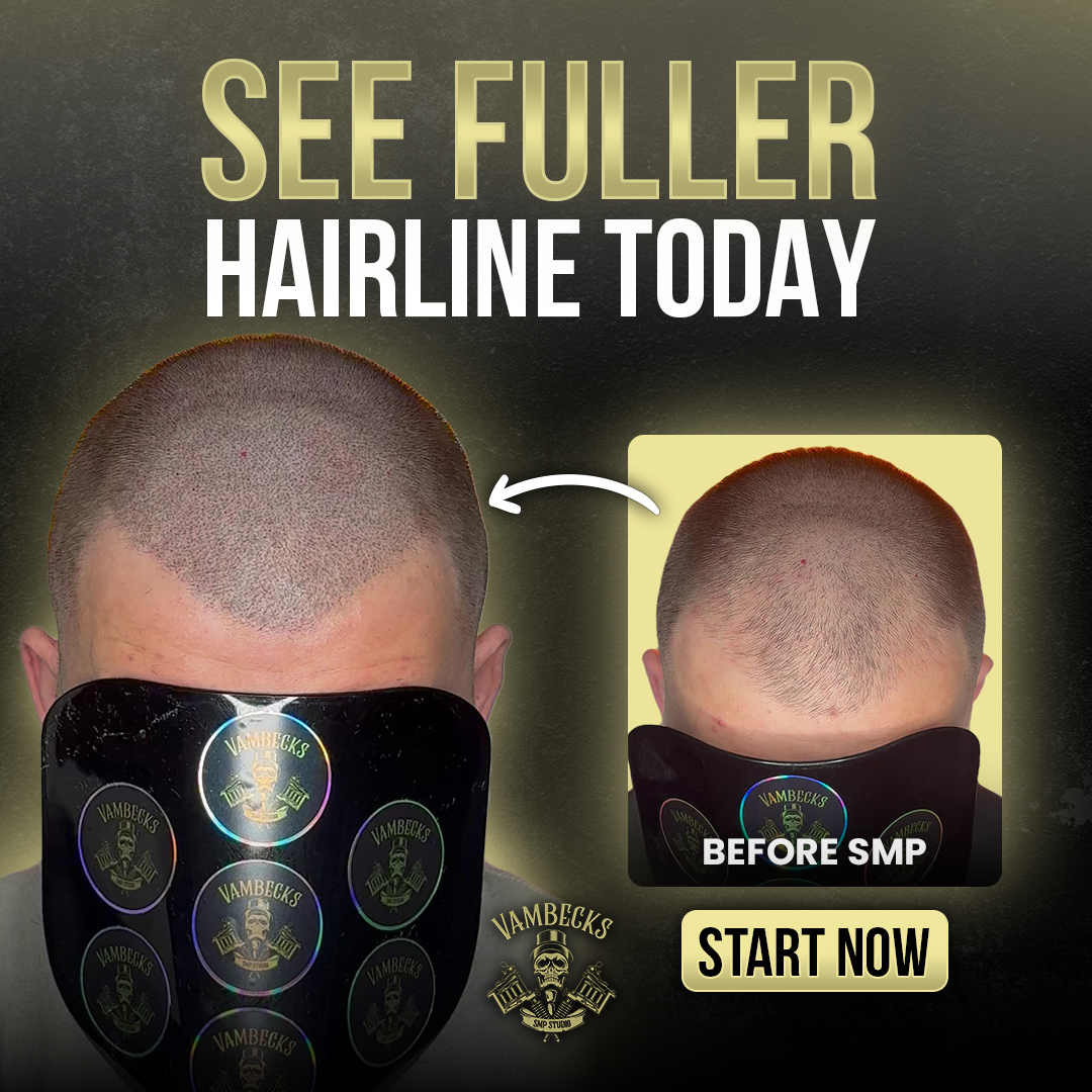 Vambecks SMP Facebook ad: Donegal, Stop Hair Loss Without Surgery