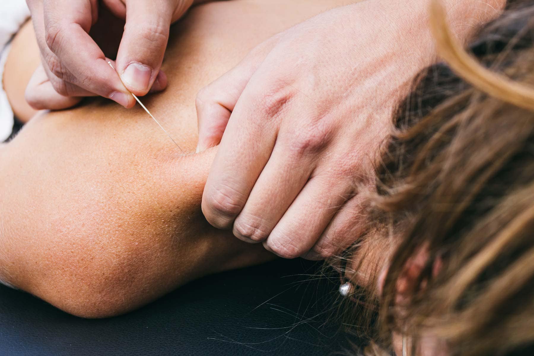 Katerina Chiro Massage Needles Facebook ad: Looking for relief from sciatica, migraines, trapped nerves…
