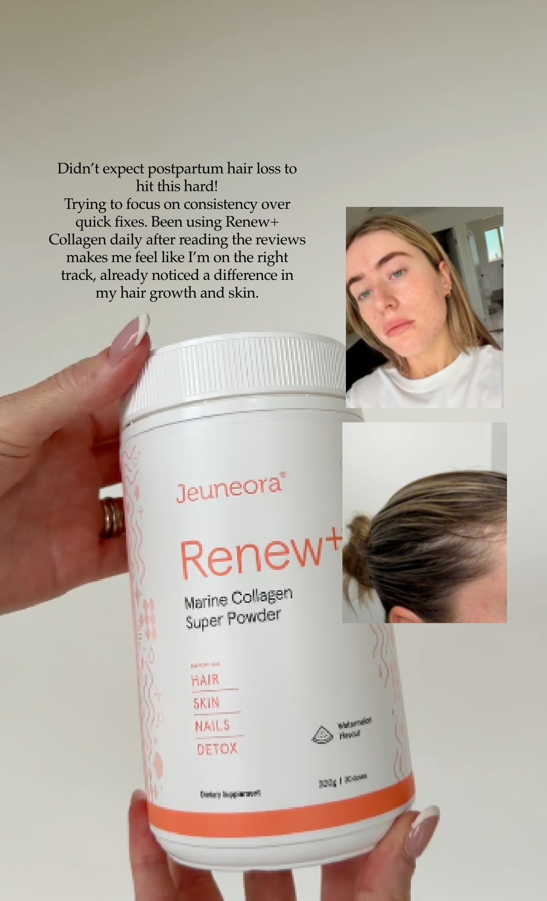 Jeuneora Facebook ad: Best Collagen for Postpartum Support