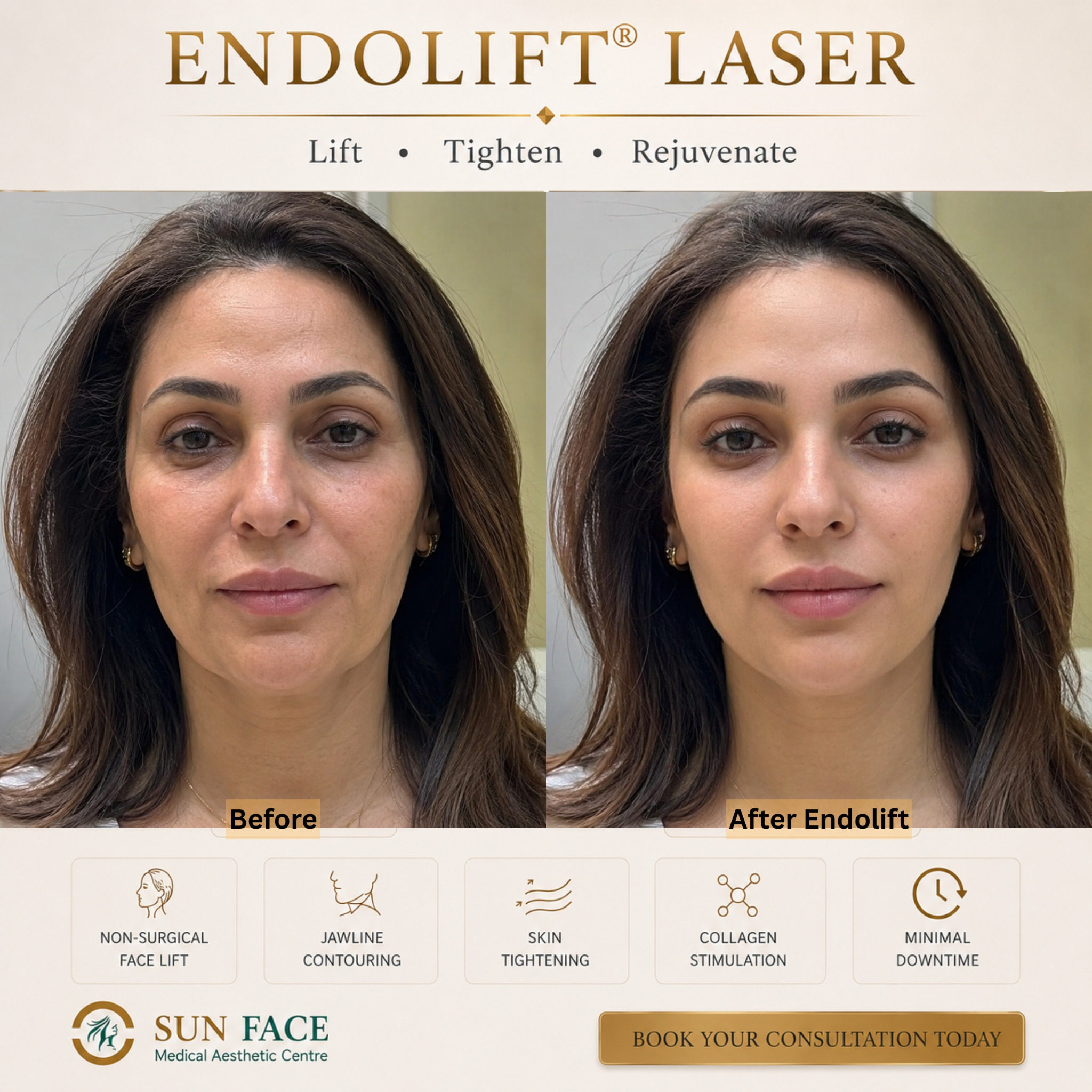 Sunface Medical Center Facebook ad from Jun 17, 2026