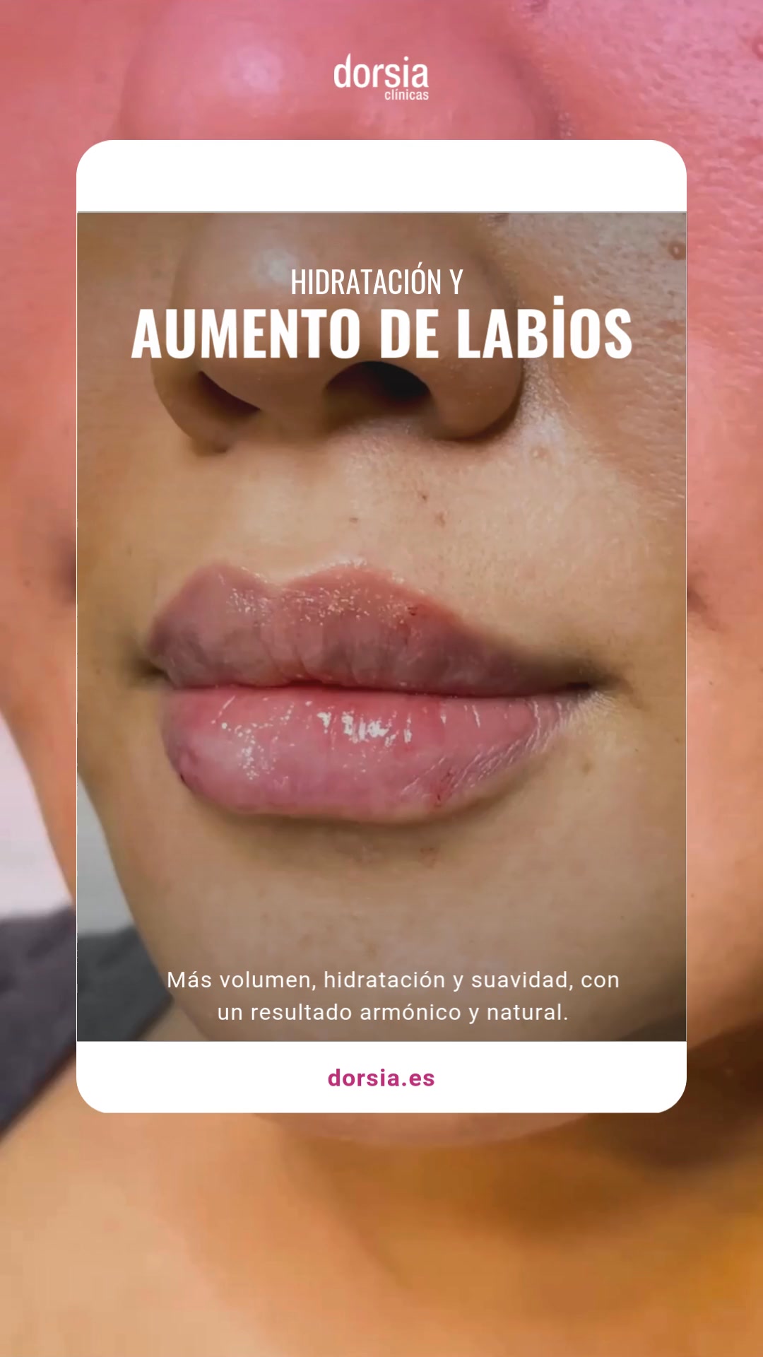 Clínicas Dorsia Facebook ad from Jan 21, 2026