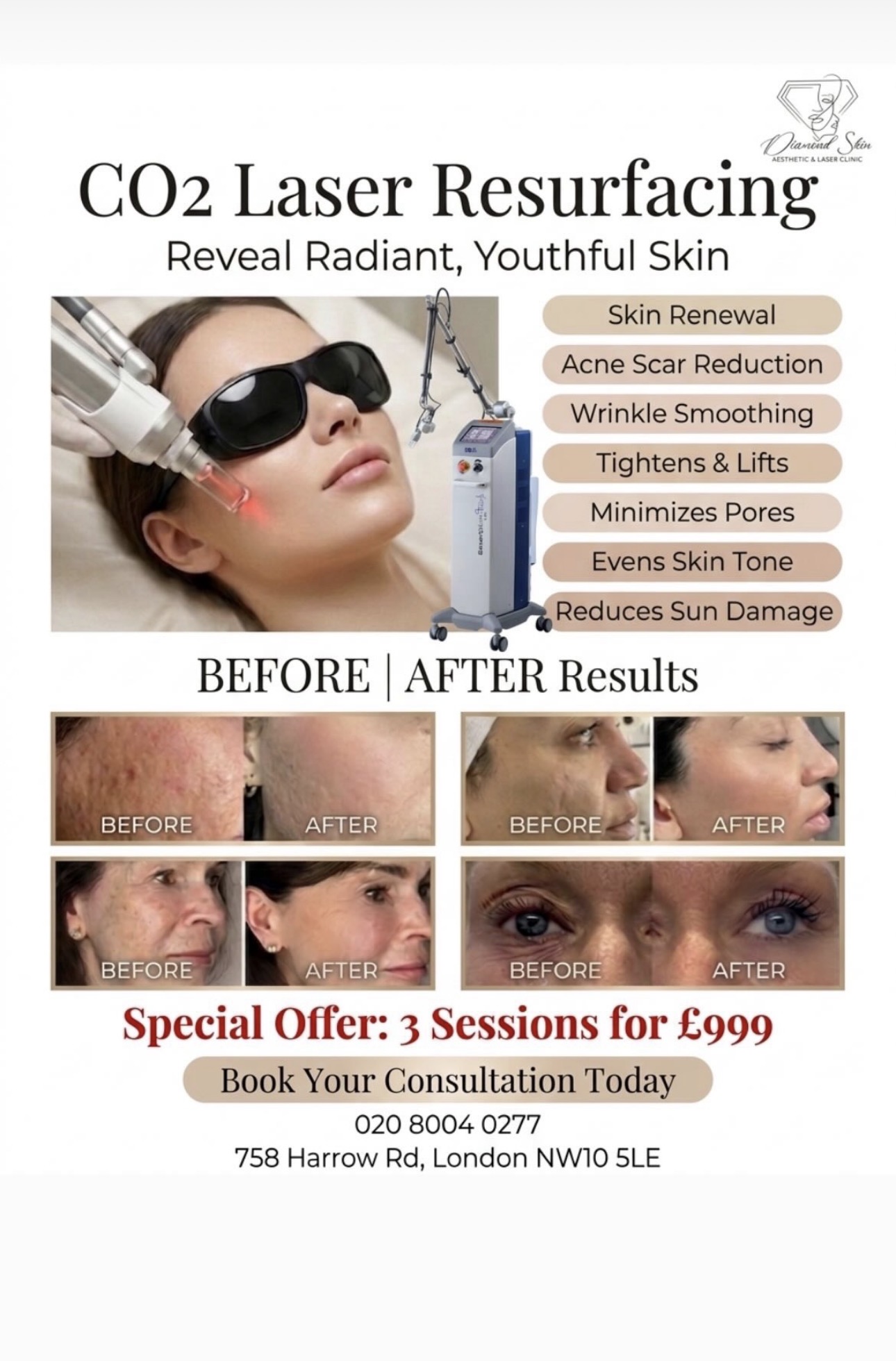 D S LASER Skin Clinic Facebook ad: CO2 Laser Resurfacing, 3 Sessions for £999