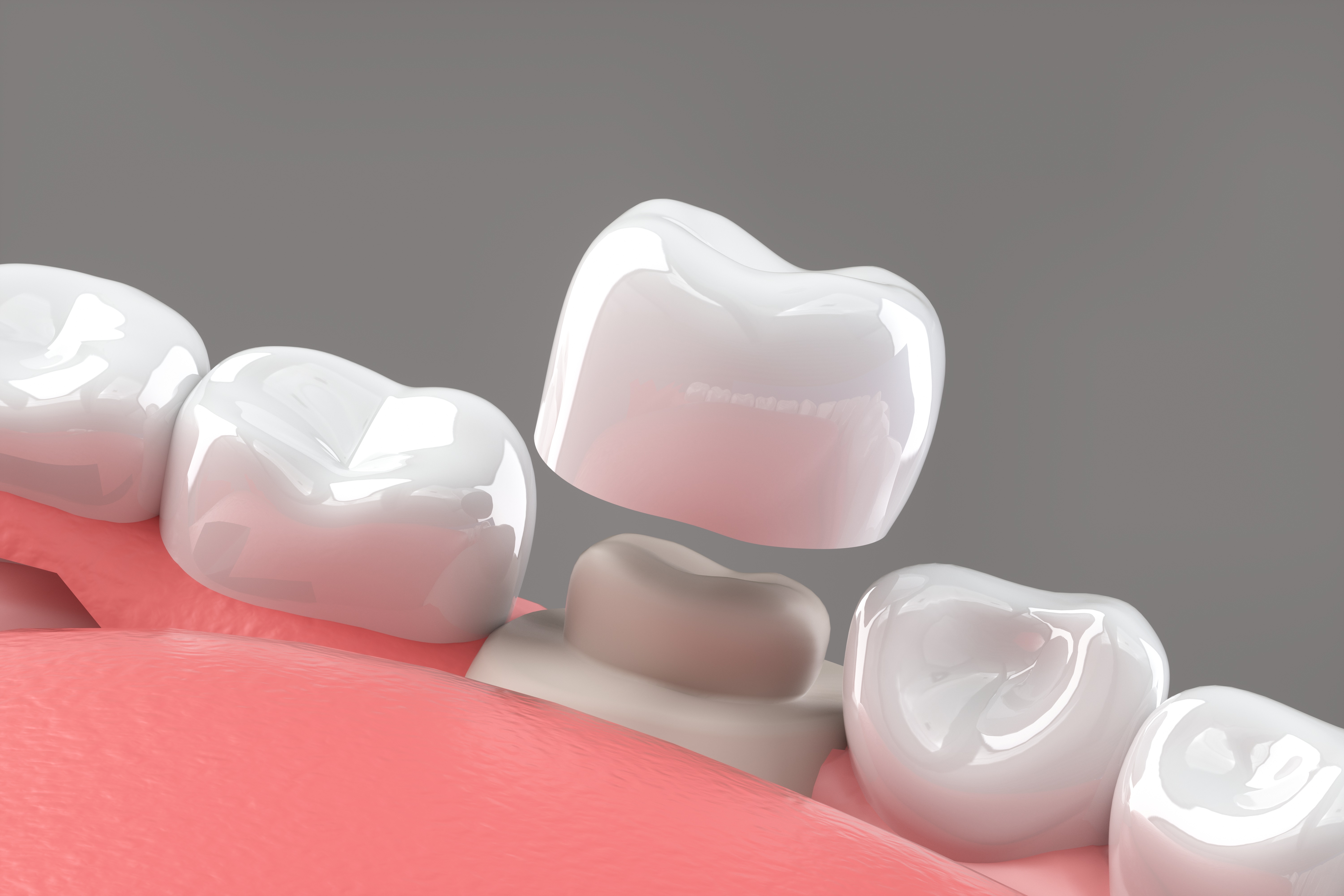 Warrington Dental Facebook ad: Dental Crown Savings Now Available