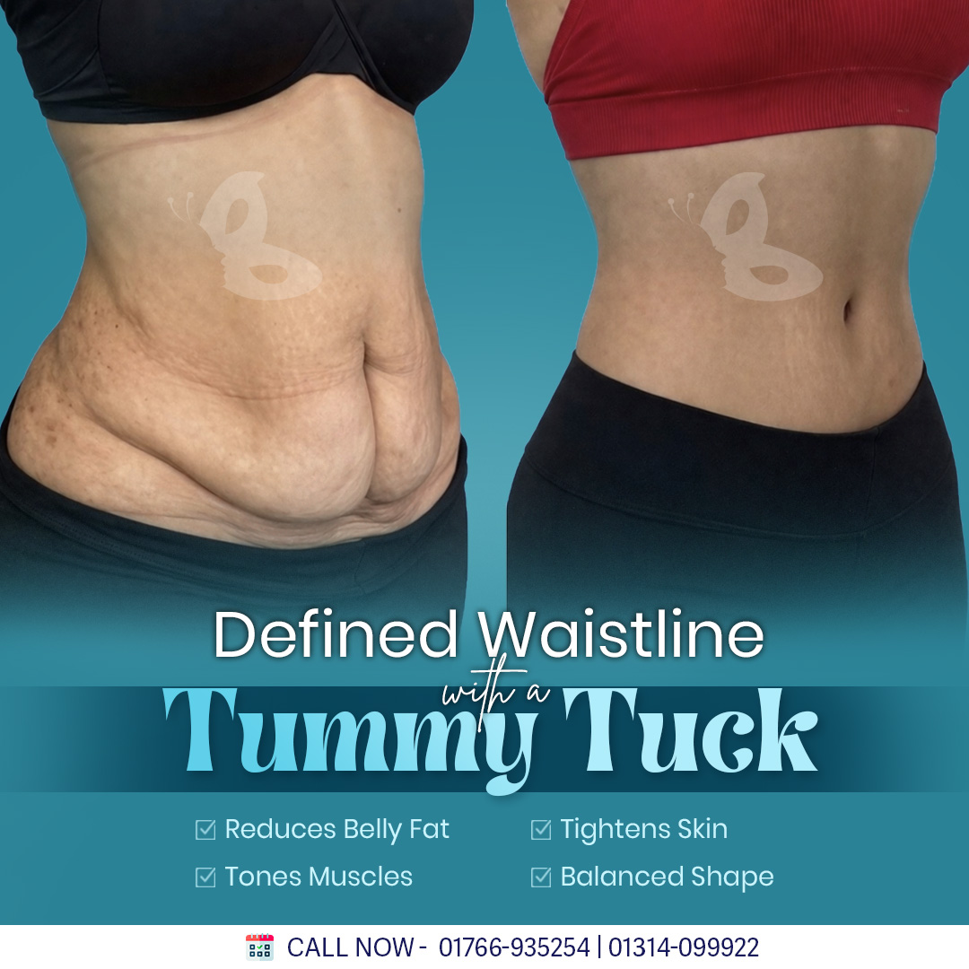 Dr. Iqbal Ahmed Plastic Surgery Facebook ad
