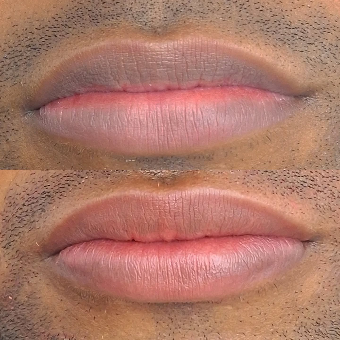 MiradasZuri Facebook ad: Micropigmentacion de labios oscuros.