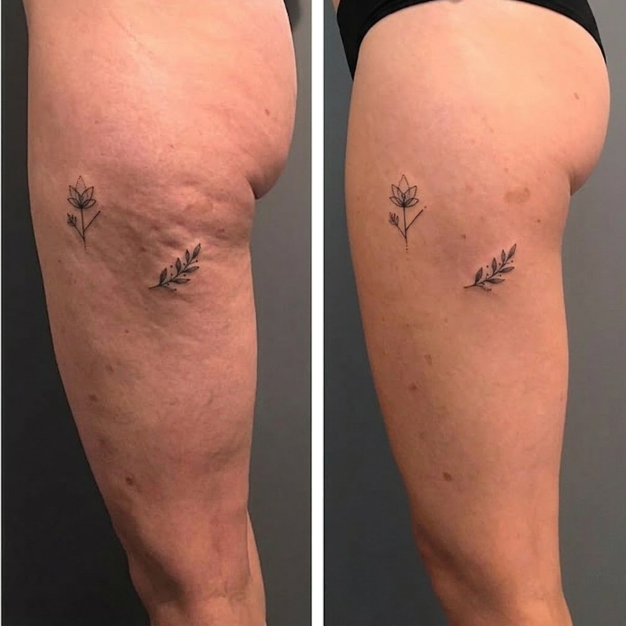 LymphCare Facebook ad