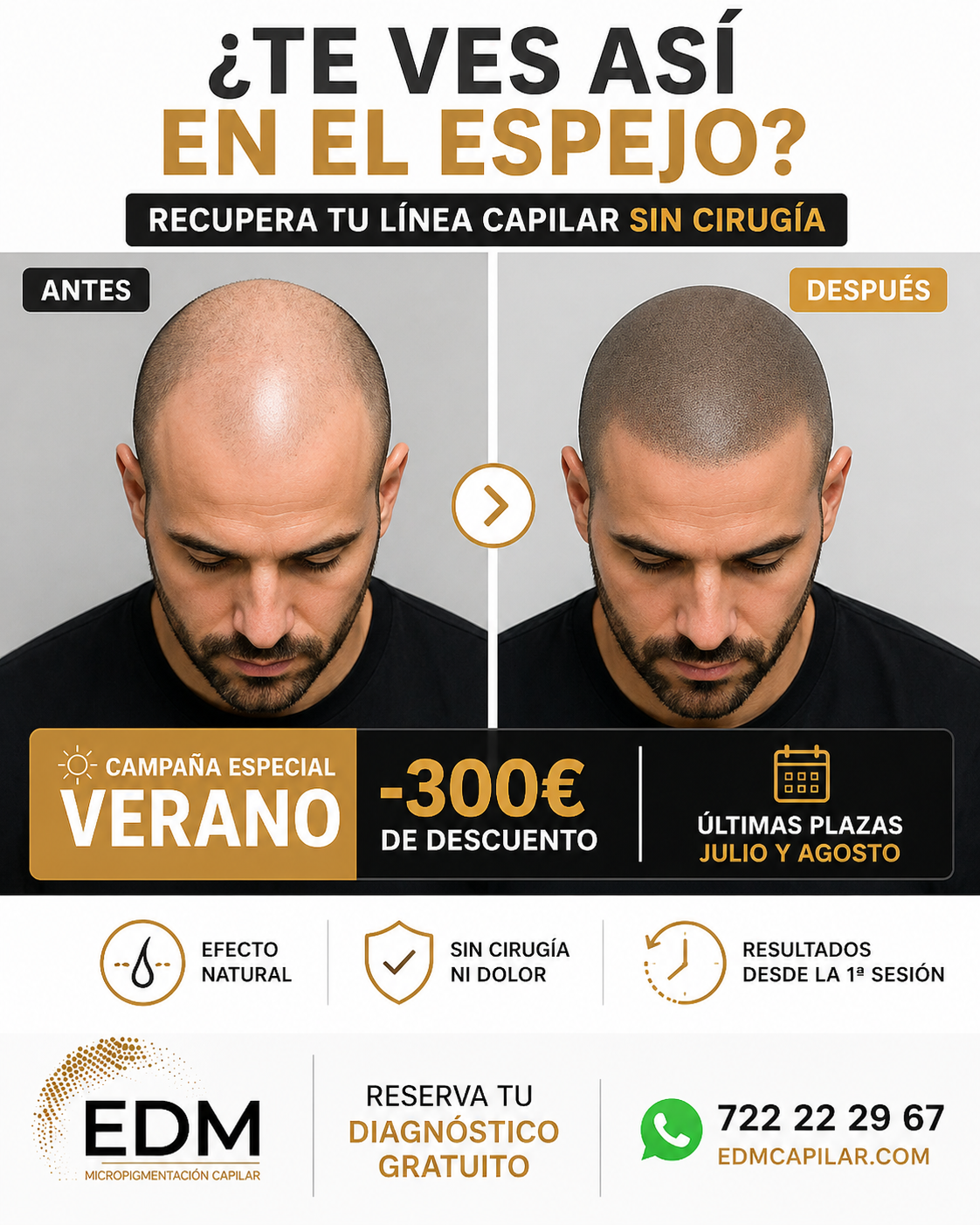 Edm Pigmentación Capilar Facebook ad