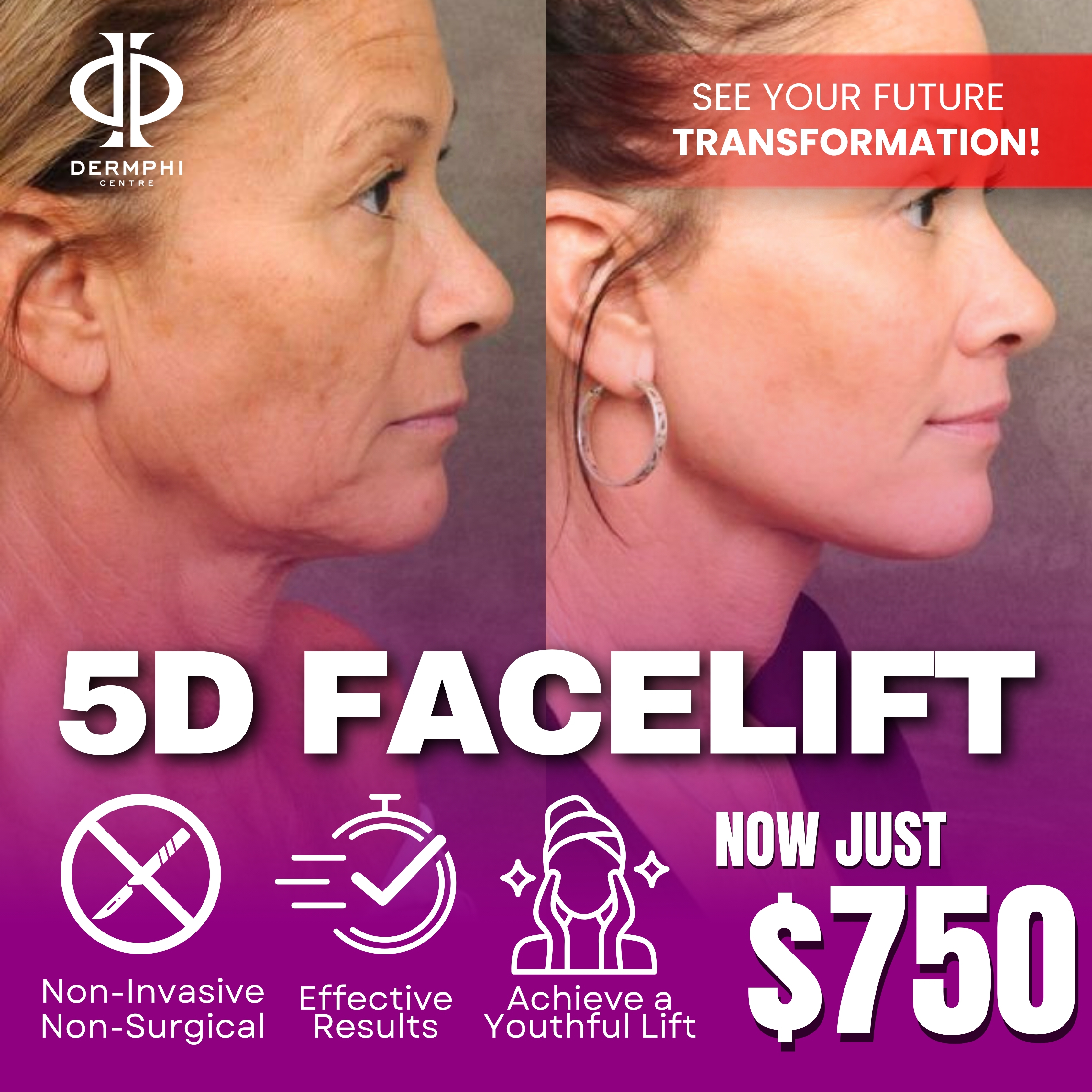 Dermphi Centre Facebook ad
