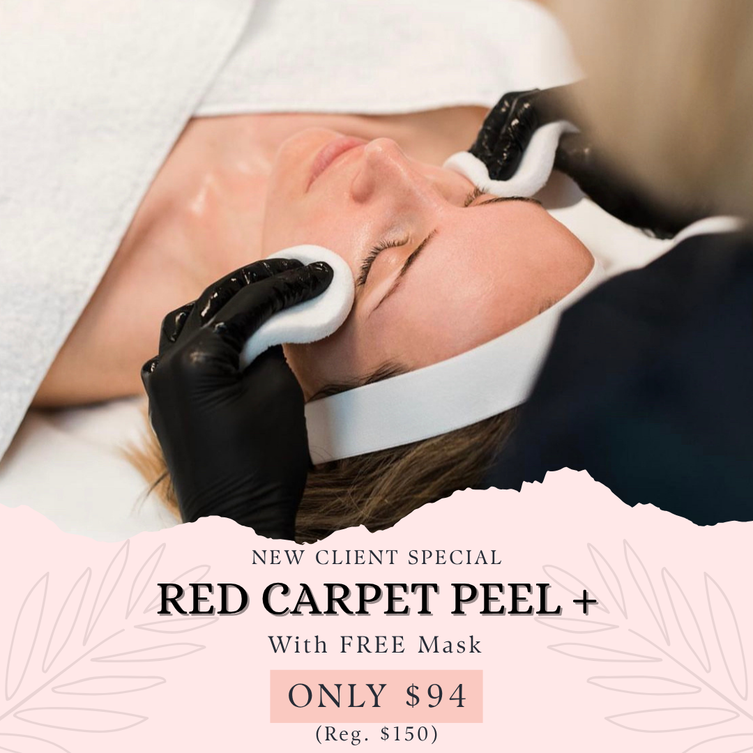 Big Country Laser Center Facebook ad: Red Carpet Peel+ JUST $94