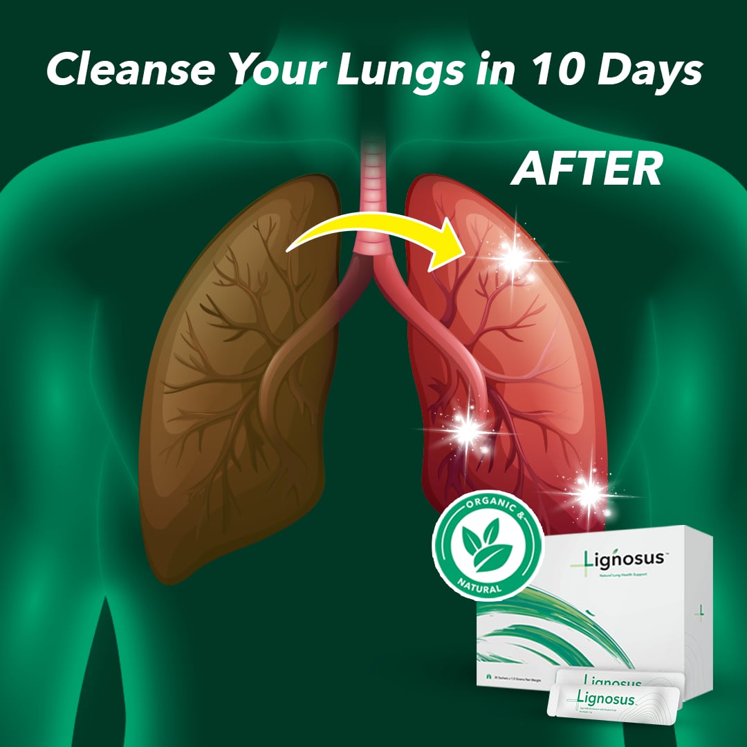 Lignosus Facebook ad