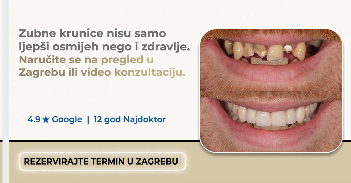 Dental Centar Mostarac Facebook ad
