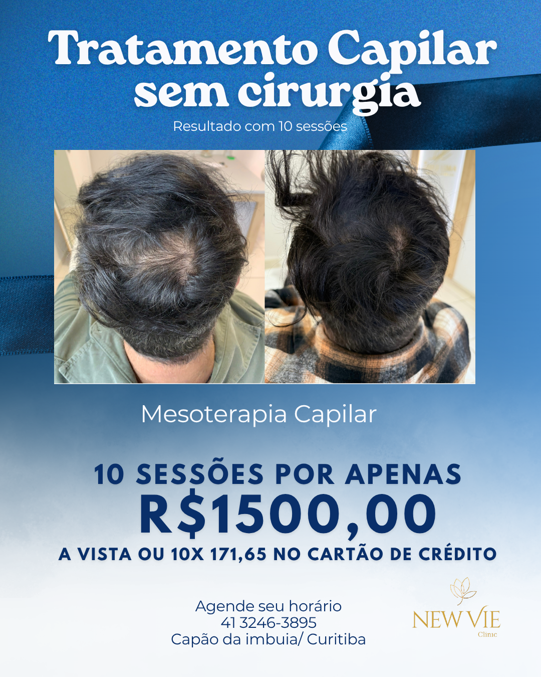 NewVie Clinic Facebook ad