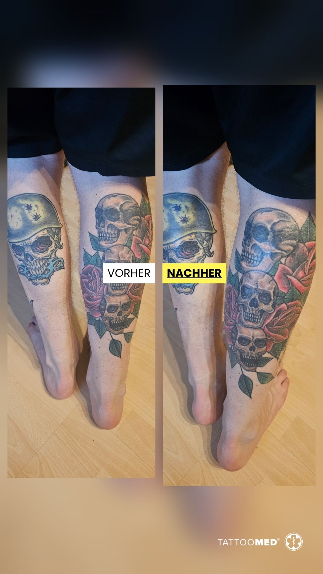 TattooMed Facebook ad